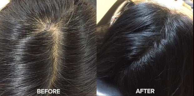 Hair Growth Conditioning Therapy